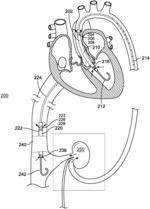 Use of cardiac assist device to improve kidney function