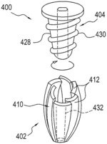 EXPANDING IMPLANT AND METHOD OF TISSUE FIXATION