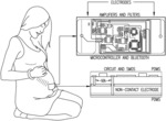 Fetal ECG and heart rate assessment and monitoring device