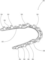Teeth repositioning systems and methods