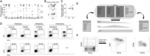 CAR T-CELLS FOR THE TREATMENT OF CD1A-POSITIVE CANCER