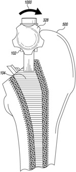 ORTHOPAEDIC BROACH EXTRACTION TOOL