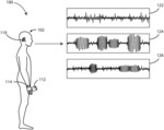 EAR-WEARABLE DEVICE SYSTEMS AND METHODS FOR MONITORING EMOTIONAL STATE