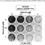 PHARMACEUTICAL COMBINATION COMPRISING TNO155 AND RIBOCICLIB