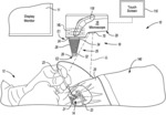 NON-CONTACT WIDE ANGLE RETINA VIEWING SYSTEM