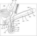 INFLATABLE PENILE PROSTHESIS WITH VALVES FOR INCREASING FLOW EFFICIENCY