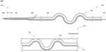 Pacemaker lead for cerclage pacing