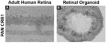 DUAL EXPRESSION VECTOR FOR GENE AUGMENTATION FOR CRUMBS COMPLEX HOMOLOGUE 1 (CRB1) MUTATIONS