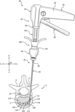 Systems And Methods For Off-Axis Augmentation Of A Vertebral Body