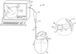 Inductive double flat coil displacement sensor