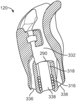 Eartip venting in a contact hearing system