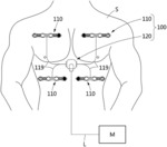 MEASUREMENT DEVICE USING EIT ELECTRODE