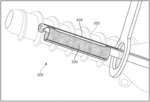 Implant Delivery Device