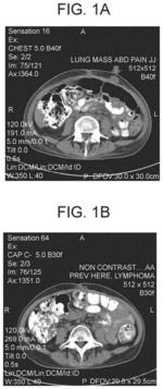 METHODS AND COMPOSITIONS FOR TREATING VIRAL OR VIRALLY-INDUCED CONDITIONS