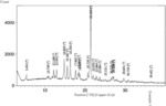 ORAL SOLID TABLET COMPRISING BRUTON'S TYROSINE KINASE INHIBITOR AND PREPARATION METHOD THEREFOR