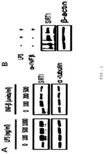 Composition containing inducer of SIRT1 expression for preventing or treating sepsis or septic shock