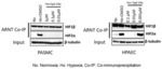 Hypoxia inducible factor-2(alpha) inhibitors and their use in the treatment of diseases