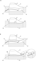 METHOD AND INJECTION MOLDING SYSTEM FOR THE DIRECT SOLING OF A MULTILAYERED SHOE SOLE