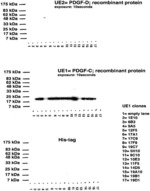 METHODS AND COMPOSITIONS FOR PDGF-CC INHIBITION