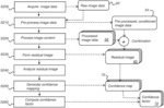 CONFIDENCE MAP FOR RADIOGRAPHIC IMAGE OPTIMIZATION