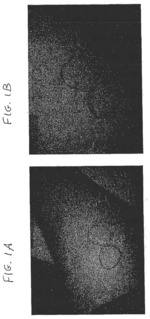 COMPOSITIONS AND METHODS FOR TREATMENT OF INFECTION AND NOVEL COSMECEUTICAL PREPARATIONS