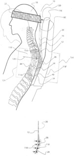 ANATOMICAL HEAD AND NECK RESTRAINING SLEEP AID AND RELATED PRODUCTS AND METHODS