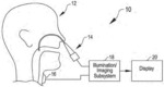 LARYNGEAL STROBOSCOPE UTILIZING SOLID STATE LIGHT SOURCES