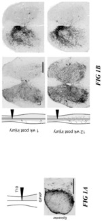 Methods of promoting corticospinal neuronal outgrowth in neuronal lesions using a pro-regenerative human osteopontin fragment