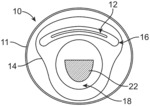 TRANSCATHETER MITRAL ANNULOPLASTY SYSTEMS, DEVICES AND METHODS