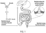 Methods for treating cholestasis