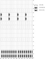 CSI reference signaling in LTE/NR coexistence