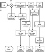 ULTRASONIC SHEARWAVE IMAGING WITH PATIENT-ADAPTIVE SHEARWAVE GENERATION