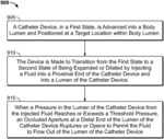 Catheters with Expandable and Collapsible Lumens