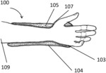 EXPANDING FOAM-FABRIC ORTHOPEDIC LIMB STABILIZATION DEVICE