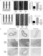 DRUG FOR TREATING ARTERY-RELATED DISEASES, AND USE THEREOF