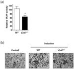 COMPOSITION, COMPRISING COTL1 AS ACTIVE INGREDIENT, FOR DIAGNOSIS OF BONE DISEASE OR OBESITY