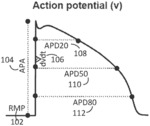 COMBINATION OF EXISTING DRUGS TO REPAIR THE ACTION POTENTIALS OF CELLS