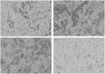 MESOTHELIN CHIMERIC ANTIGEN RECEPTOR (CAR) AND ANTIBODY AGAINST PD-L1 INHIBITOR FOR COMBINED USE IN ANTICANCER THERAPY