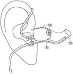 METHOD AND APPARATUS FOR AUTOMATIC CORRECTION OF REAL EAR MEASUREMENTS