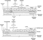 INGESTIBLE DEVICE FOR DELIVERY OF THERAPEUTIC AGENT TO THE GASTROINTESTINAL TRACT