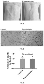 Preparation method and use of artificial exosome complex