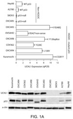 Inhibition of UCHL1 in high-grade serous ovarian cancer