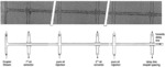 MICROFLUIDIC SYSTEMS AND METHODS FOR REDUCING THE EXCHANGE OF MOLECULES BETWEEN DROPLETS