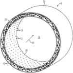 RESONATOR RING FOR COMBUSTION CHAMBER SYSTEMS