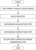 Ophthalmologic image processing method and fundus imaging apparatus