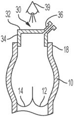 DEVICE FOR VISUALIZATION OF VALVE DURING SURGERY