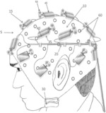 METHOD AND APPARATUS FOR PROVIDING TRANSCRANIAL MAGNETIC STIMULATION (TMS) TO AN INDIVIDUAL