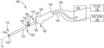 IRRIGATION DEVICES IN DEBRIDEMENT SYSTEMS