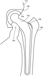 PIEZOELECTRIC BONE CEMENTS AND CELL CULTURE DISHES