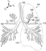 SYSTEMS AND METHODS FOR INDICATING APPROACH TO AN ANATOMICAL BOUNDARY